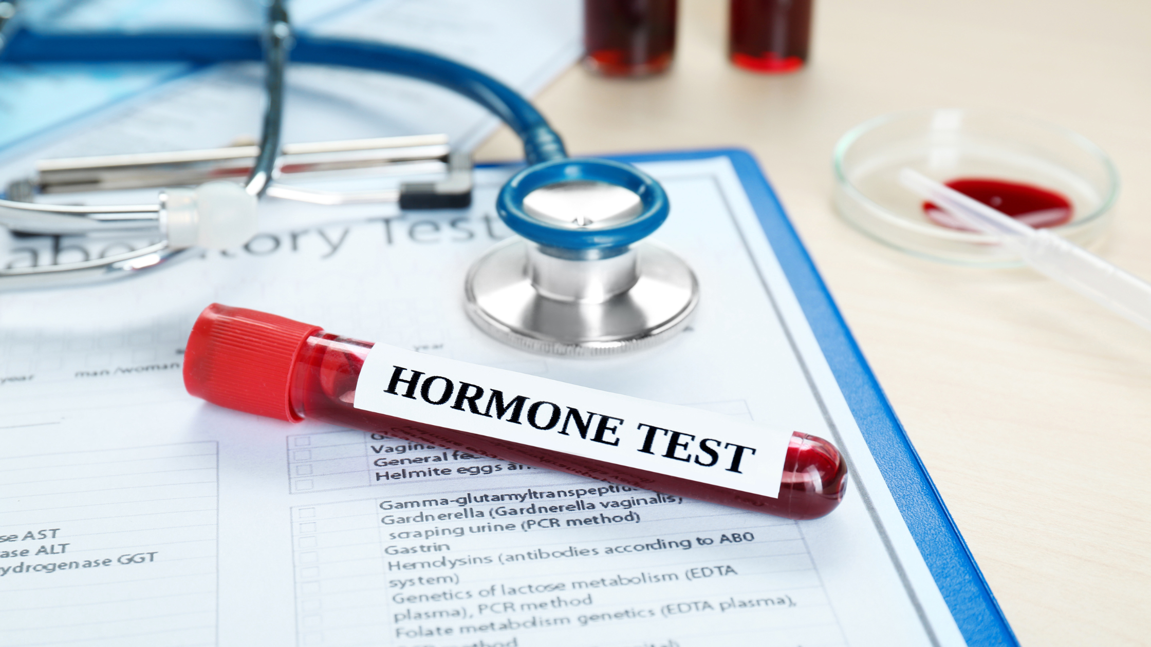 Testosterone lab test results showing hormone imbalance in women’s health